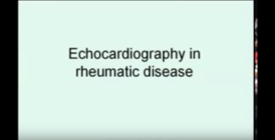Echocardiography in RHD | Ben Reeves