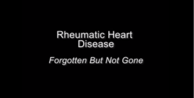 RHD: forgotten but not gone