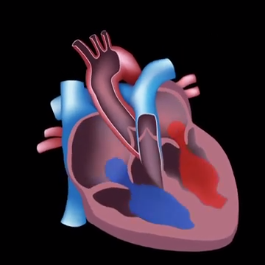 Physiology of RHD. eLearning Intro Vid 3